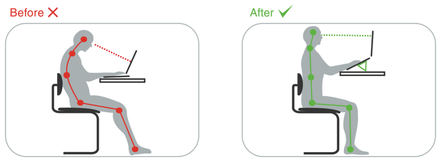Before and after ergonomic setup comparison